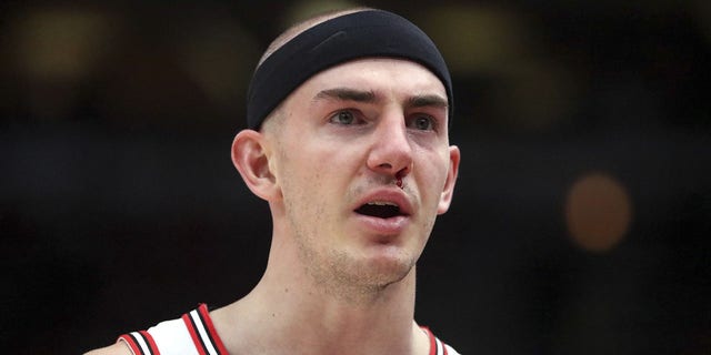 Bulls guard Alex Caruso (6) suffered a bloodied nose in the first half against the Bucks at the United Center in Chicago on April 24, 2022. 