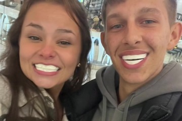 Man and his pal show off their Turkey teeth, but it's not quite as it seems 
