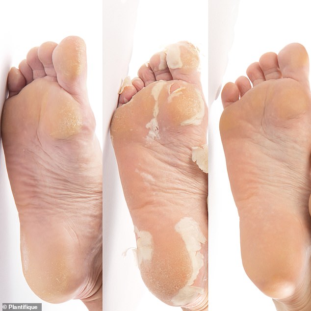 Easy to use, there are only three steps to soft feet in less than two weeks - Soak. Apply. Wash