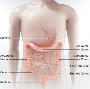 Colorectal cancer  is a type of cancer that begins in the large intestine