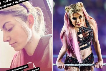 WWE star Alexa Bliss reveals skin cancer battle & calls on fans to get checked